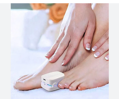 Lampara Laser De Uñas (Elimina Hongos)