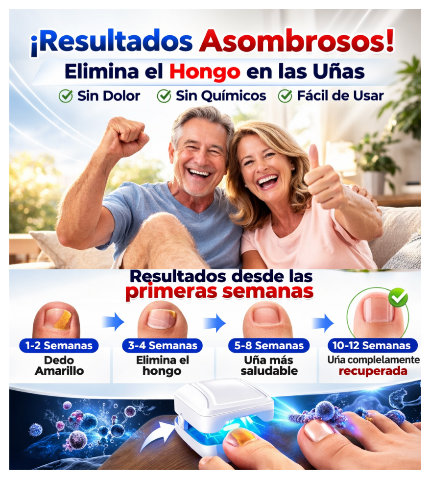 Lampara Laser De Uñas (Elimina Hongos)