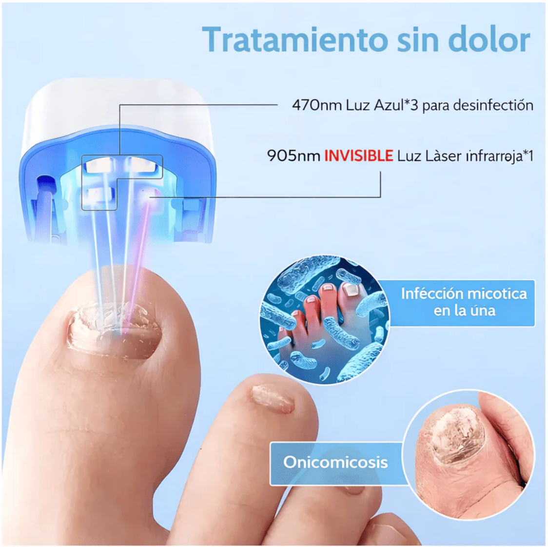 Lampara Laser De Uñas (Elimina Hongos)