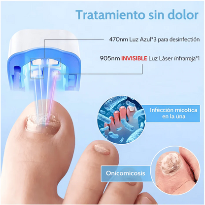 Lampara Laser De Uñas (Elimina Hongos)